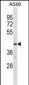 GPR52 Antibody(C-term)