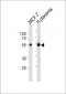 ESR2 Antibody(C-term)