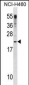 CSF3 Antibody(C-term)