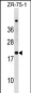 CDKN2A Antibody(N-term S8)