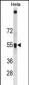 SQSTM1 Antibody(C-term S403)