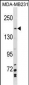 MYBBP1A Antibody(N-term)