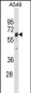 TRIM22 Antibody(N-term)