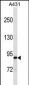 EPS8L2 Antibody(N-term)