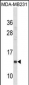 IFITM1 Antibody(Center)