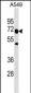 TRAF6 Antibody(Center)