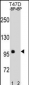 CTNNB1 Antibody(C-term)