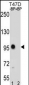 CTNNB1 Antibody(C-term)