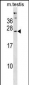 PHOSPHO2 Antibody(N-term)