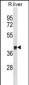 Rat Arg1 Antibody(C-term)