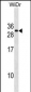 FADD Antibody(Center)