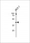 ESR2 Antibody(C-term)