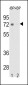 ESR1 isoform1 Antibody(C-term)