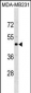 CCR5 Antibody(Center)