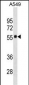 SCARB1 Antibody(N-term)