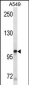 KIT Antibody 