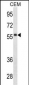 IGHD Antibody (N-term)