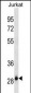 HAGH Antibody (C-term) (Ascites)
