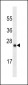LYPD6B Antibody (Center) (Ascites)