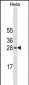 COMT Antibody (N-term) (Ascites)