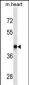 DRD4 Antibody (Center)