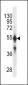 CYP2C9 Antibody (N-term) (Ascites)