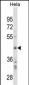 SPARC Antibody(C-term) Antibody(Ascites)