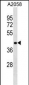 RNF149 Antibody(Center)