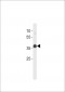 ESR1 isoform4 Antibody(C-term)