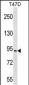 CHUK Antibody(C-term)