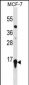 HIST2H3A Antibody(C-term)