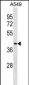 DPEP1 Antibody(N-term)