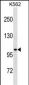 STARD13 Antibody(Center)