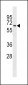 MBOAT7 Antibody(Center)