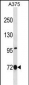 ANXA6 Antibody(C-term)