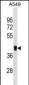 MKRN1 Antibody(Center)