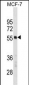 PTBP1 Antibody(N-term)