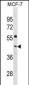 PCYT1A Antibody(C-term)