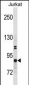 CHUK Antibody(N-term)