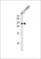 ASCL1 Antibody(N-term)