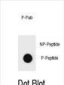 Phospho-PTEN(S385) Antibody
