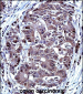 TYSY Antibody(C-term)