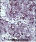 TYSY Antibody(C-term)