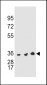 TYSY Antibody(C-term)