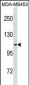 ENPP3 Antibody(C-term)