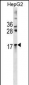 CRYAA Antibody(Center)