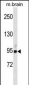 BRSK1 Antibody(Center)