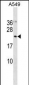 UFC1 Antibody (N-term)