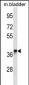 CRYM Antibody (Center)