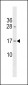 GAPT Antibody(Center)